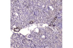 IHC testing of FFPE mouse kidney tissue with CKB antibody at 1ug/ml. (CKB antibody)