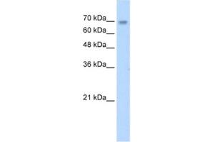 Western Blotting (WB) image for anti-Zinc Finger Protein 264 (ZNF264) antibody (ABIN2461695) (ZNF264 antibody)