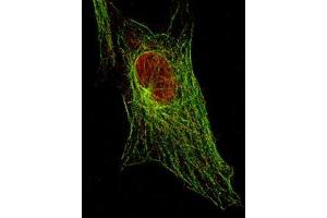 Immunofluorescence (IF) image for anti-Signal Transducer and Activator of Transcription 5A (STAT5A) (pTyr694) antibody (ABIN349611)