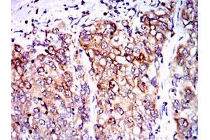 Immunohistochemistry (IHC) image for anti-Protein Phosphatase 2A Activator, Regulatory Subunit 4 (PPP2R4) antibody (ABIN1108715) (PPP2R4 antibody)