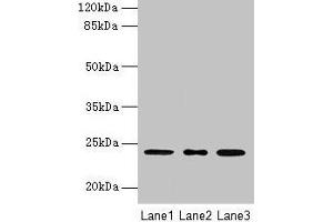 Western blot All lanes: MRPL58 antibody at 2 μg/mL Lane 1: A549 whole cell lysate Lane 2: Jurkat whole cell lysate Lane 3: K562 whole cell lysate Secondary Goat polyclonal to rabbit IgG at 1/10000 dilution Predicted band size: 24 kDa Observed band size: 24 kDa (Peptidyl-tRNA Hydrolase ICT1, Mitochondrial (AA 30-206) antibody)