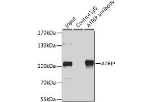 Immunoprecipitation analysis of 200 μg extracts of HeLa cells using 1 μg ATRIP antibody (ABIN1678799, ABIN3019346, ABIN3019347 and ABIN6220835). (ATRIP antibody  (AA 1-260))