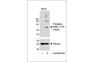 Western blot analysis of lysates from Hela cell line, untreated or treated with Nocodazole, 100 ng/mL, using Phospho-PBK/TOPK (Thr9) Antibody (upper) or Tubulin (lower). (PBK antibody  (pThr9))