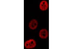 ABIN6276644 staining  NIH-3T3 cells by IF/ICC. (PSMA3 antibody  (Internal Region))