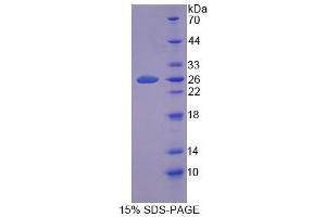 SDS-PAGE (SDS) image for Pantothenate Kinase 1 (PANK1) (AA 298-500) protein (His tag) (ABIN6239199) (PANK1 Protein (AA 298-500) (His tag))