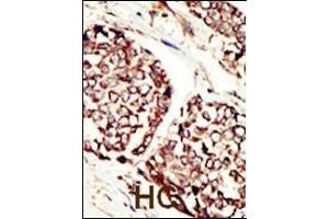 Immunohistochemistry (Paraffin-embedded Sections) (IHC (p)) image for anti-Receptor Tyrosine-Protein Kinase ErbB-3 (ERBB3) (AA 24-55), (N-Term) antibody (ABIN391949)