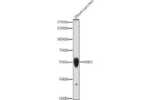 Western blot analysis of extracts of Mouse pancreas, using MEIS1 antibody (ABIN7268449) at 1:1000 dilution. (MEIS1 antibody)