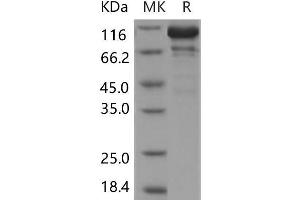 Western Blotting (WB) image for Protein tyrosine Phosphatase, Receptor Type, C (PTPRC) (Active) protein (GST tag,His tag) (ABIN7320006) (CD45 Protein (GST tag,His tag))
