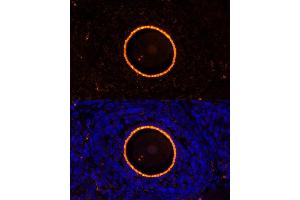 Immunofluorescence analysis of rat oophoroma cells using ZP2 antibody (ABIN6128965, ABIN6150534, ABIN6150535 and ABIN6214263) at dilution of 1:100. (ZP2 antibody  (AA 651-745))