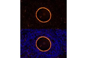 Immunofluorescence analysis of rat oophoroma cells using ZP2 antibody (ABIN6128965, ABIN6150534, ABIN6150535 and ABIN6214263) at dilution of 1:100. (ZP2 antibody  (AA 651-745))