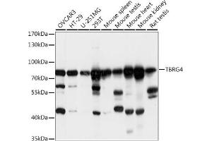 Western blot analysis of extracts of various cell lines, using TBRG4 antibody  at 1:1000 dilution. (TBRG4 antibody  (AA 382-631))