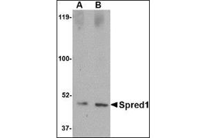 Western blot analysis of Spred1 in human brain tissue lysate with this product at (A) 1 and (B) 2 μg/ml. (SPRED1 antibody  (Center))