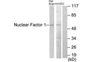 Western blot analysis of extracts from rat brain/HuvEc cells, using Nuclear Factor 1 Antibody. (Nuclear Factor 1 antibody  (AA 11-60))