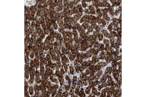 Immunohistochemical staining (Formalin-fixed paraffin-embedded sections) of human liver with KCNMB3 polyclonal antibody  shows strong cytoplasmic positivity in hepatocytes. (KCNMB3 antibody)