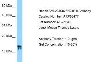 Western Blotting (WB) image for anti-Chromosome 9 Open Reading Frame 25 (C9orf25) (N-Term) antibody (ABIN2786226) (C9orf25 antibody  (N-Term))