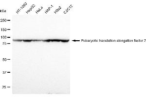 Western blotting analysis using Eukaryotic translation elongation factor 2 antibody (ABIN7798502).