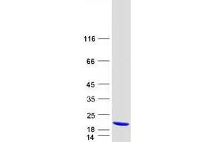 Validation with Western Blot (THEM2 Protein (Myc-DYKDDDDK Tag))