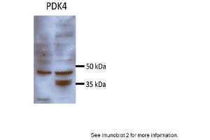 Sample Type: Huh7 HepG2 (50ug)Primary Antibody Dilution: 1:500 Image Submitted By: Partha KasturiUniversity of Kansas Medical Center (PDK4 antibody  (N-Term))