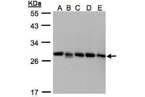 WB Image Sample(30μg whole cell lysate) A: 293T B: A431 , C: H1299 D: HeLa S3 , E: Hep G2 , 12% SDS PAGE antibody diluted at 1:1000 (ARHGDIB antibody)