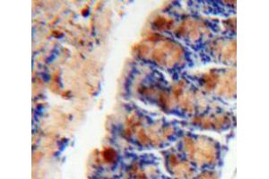 Used in DAB staining on fromalin fixed paraffin-embedded Intestine tissue (Mucosae Associated Epithelia Chemokine (AA 20-115) antibody)