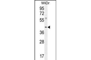 DUS4L Antibody (Center) (ABIN654982 and ABIN2844622) western blot analysis in WiDr cell line lysates (35 μg/lane). (DUS4L antibody  (AA 141-170))