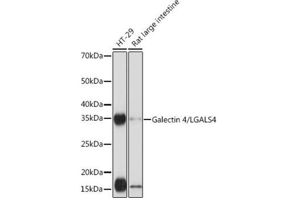 GAL4 antibody