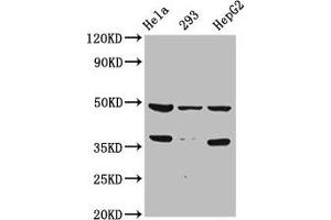 Western Blot Positive WB detected in: Hela whole cell lysate, 293 whole cell lysate, HepG2 whole cell lysate All lanes: SOX4 antibody at 1:2000 Secondary Goat polyclonal to rabbit IgG at 1/50000 dilution Predicted band size: 48 kDa Observed band size: 48 kDa (SOX4 antibody  (AA 1-60))