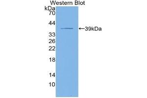 Detection of Recombinant KRT4, Human using Polyclonal Antibody to Cytokeratin 4 (CK4) (KRT4 antibody  (AA 152-457))