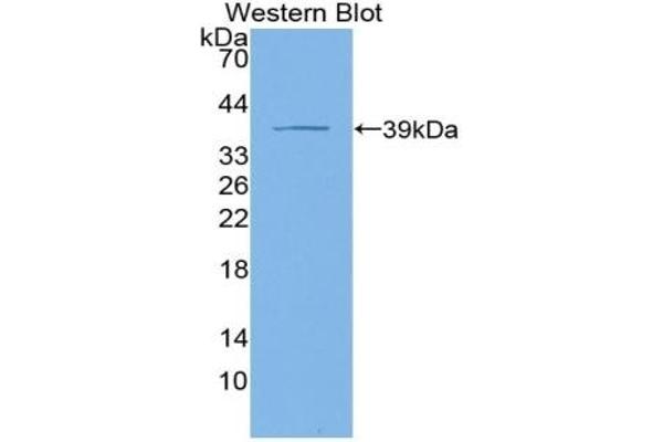 KRT4 anticorps  (AA 152-457)