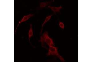 ABIN6266814 staining COLO205 cells by IF/ICC. (LRAT antibody  (Internal Region))