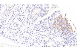 Detection of IL1RA in Rabbit Colon Tissue using Polyclonal Antibody to Interleukin 1 Receptor Antagonist (IL1RA) (IL1RN antibody  (AA 26-177))