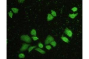 Detection of CASP8 in Hela cells using Polyclonal Antibody to Caspase 8 (CASP8) (Caspase 8 antibody  (AA 7-201))