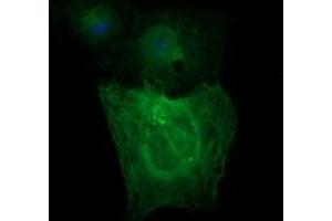 Image no. 1 for anti-Tubulin, beta 2A (TUBB2A) antibody (ABIN1501567) (TUBB2A antibody)