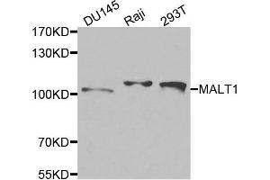 Western blot analysis of extracts of various cells, using MALT1 antibody. (MALT1 antibody)