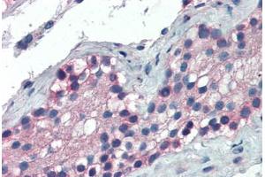 Human Testis (formalin-fixed, paraffin-embedded) stained with FOXE1 antibody ABIN337218 at 2. (FOXE1 antibody  (AA 361-373))