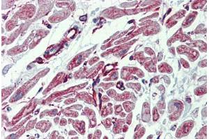 Heart, Human: Formalin-Fixed, Paraffin-Embedded (FFPE) (PHACTR1 antibody  (AA 468-517))