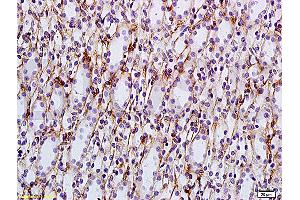 Formalin-fixed and paraffin embedded: rat kidney tissue labeled with Anti-AQP-2 Polyclonal Antibody, Unconjugated (ABIN1385618) at 1:200, followed by conjugation to the secondary antibody and DAB staining (AQP2 antibody  (AA 101-200))