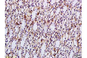Formalin-fixed and paraffin embedded: rat kidney tissue labeled with Anti-AQP-2 Polyclonal Antibody, Unconjugated (ABIN1385618) at 1:200, followed by conjugation to the secondary antibody and DAB staining (AQP2 antibody  (AA 101-200))