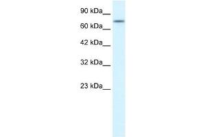 RIPK1 antibody (70R-10453) used at 5 ug/ml to detect target protein. (RIPK1 antibody  (Middle Region))