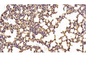 Immunohistochemistry (IHC) image for anti-Nuclear Factor-kB p65 (NFkBP65) (AA 19-306) antibody (ABIN7432211)