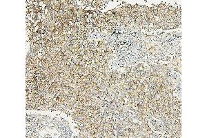 IHC analysis of ALDOA using anti-ALDOA antibody (ABIN7601907). (ALDOA antibody  (AA 50-364))