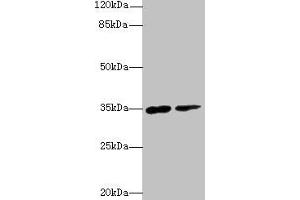 Western blot All lanes: RNF148 antibody at 6 μg/mL Lane 1: Hela whole cell lysate Lane 2: HepG2 whole cell lysate Secondary Goat polyclonal to rabbit IgG at 1/10000 dilution Predicted band size: 35 kDa Observed band size: 35 kDa (RNF148 antibody  (AA 208-305))