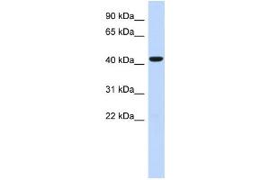 Western Blotting (WB) image for anti-Sphingomyelin Synthase 2 (SGMS2) antibody (ABIN2459622) (Sphingomyelin Synthase 2 antibody)