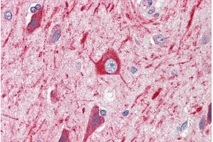 ABIN184877 (5µg/ml) staining of paraffin embedded Human Cortex. (PRDM11 antibody  (C-Term))