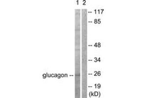 Western blot analysis of extracts from COS7 cells, using Glucagon Antibody. (Glucagon antibody  (AA 61-110))