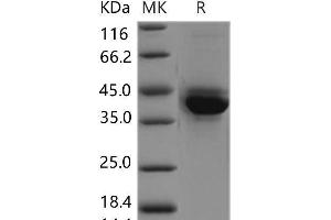 Western Blotting (WB) image for S100 Calcium Binding Protein A4 (S100A4) protein (Fc Tag) (ABIN7320263) (s100a4 Protein (Fc Tag))