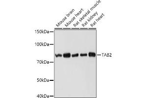 Western blot analysis of extracts of various cell lines, using T antibody (ABIN6131433, ABIN6148797, ABIN6148798 and ABIN6225202) at 1:1000 dilution. (TAB2 antibody  (AA 350-693))