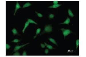 Immunostaining analysis in HeLa cells. (FKBP3 antibody)