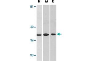 Western blot analysis of DAPK2 in A-431 (H), mouse spleen (M), and rat kidney (R) lysates with DAPK2 polyclonal antibody  at 1 ug/mL .