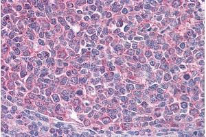 ABIN570765 (3. (ICOS antibody  (Internal Region))